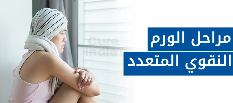 مراحل الورم النقوي المتعدد